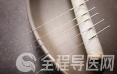 无极针发明人吴冬雪：行医40载，接诊30万人次，赢得患者好口碑